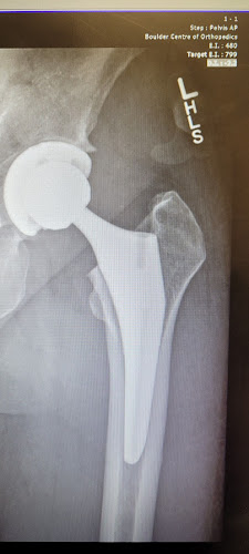 BoulderCentre for Orthopedics & Spine